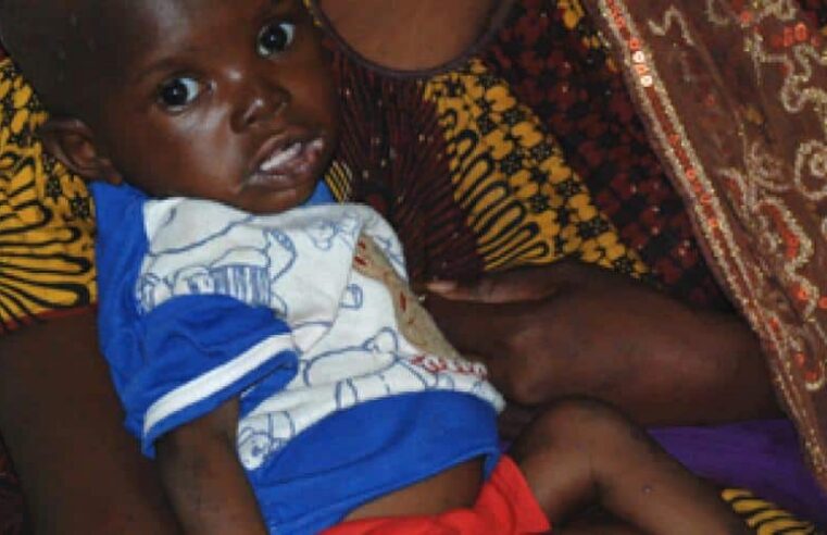 Malnutrition au Mali : enjeux et solutions pour la santé des enfants