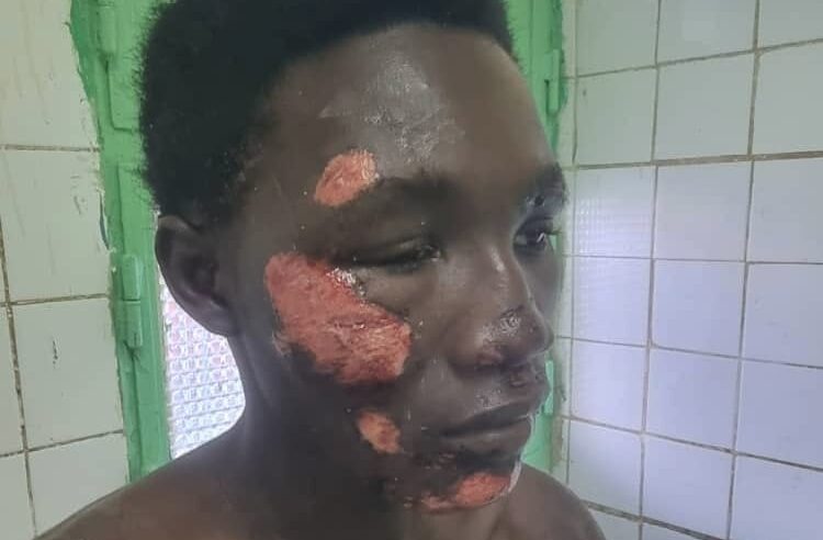 Sécurité au Tchad : un père dénonce l&rsquo;échec des autorités après une agression près du camp 27